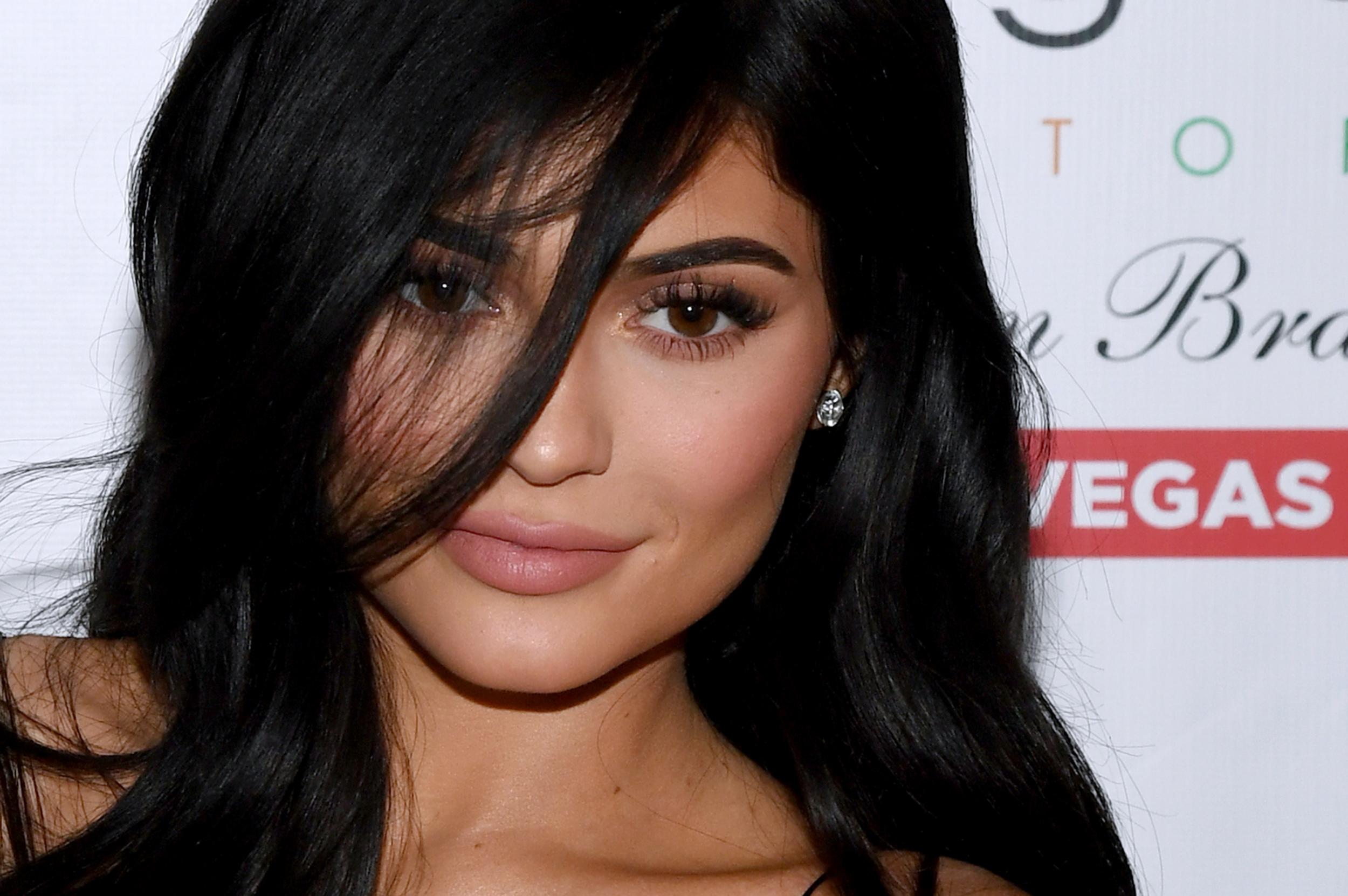 5 Things About Celebrities With Lip Fillers You May Not Have Known